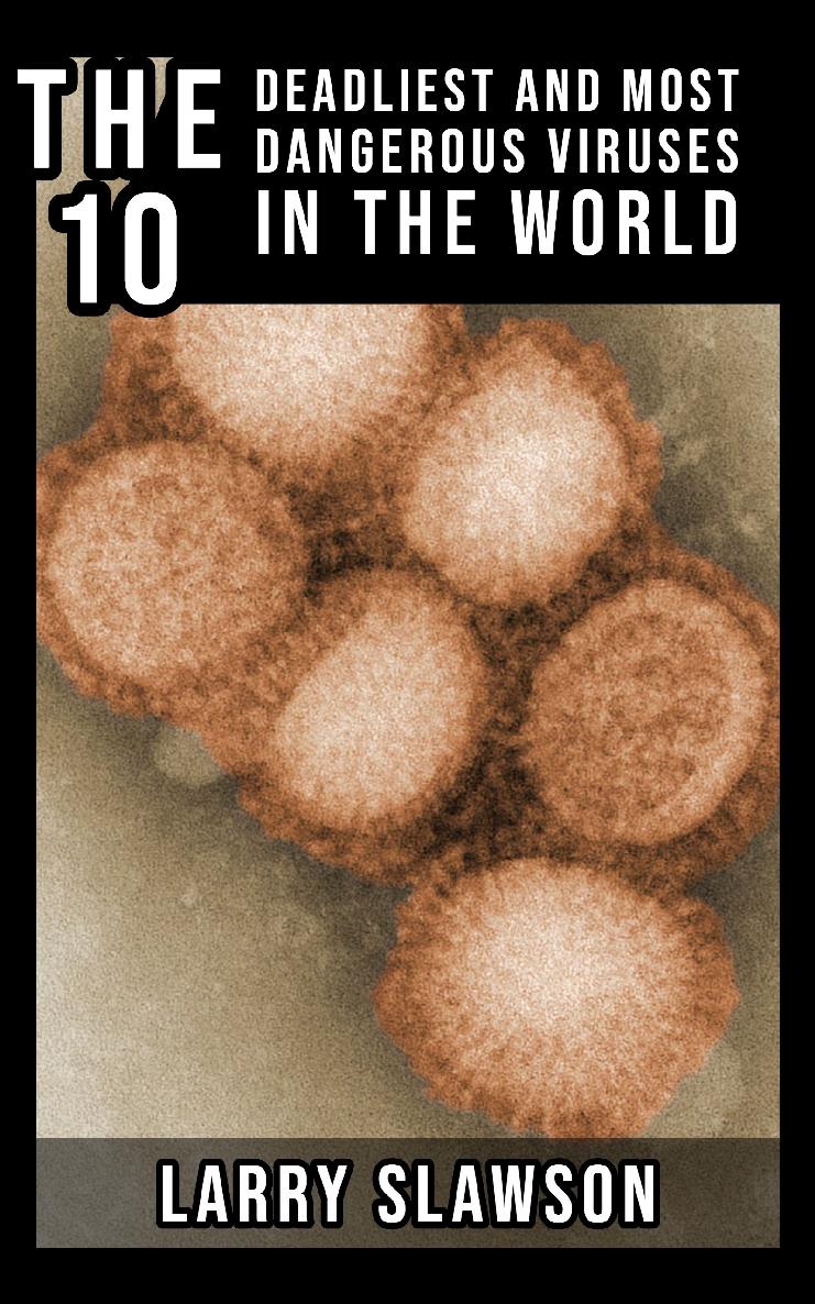 The 10 Deadliest and Most Dangerous Viruses in the World