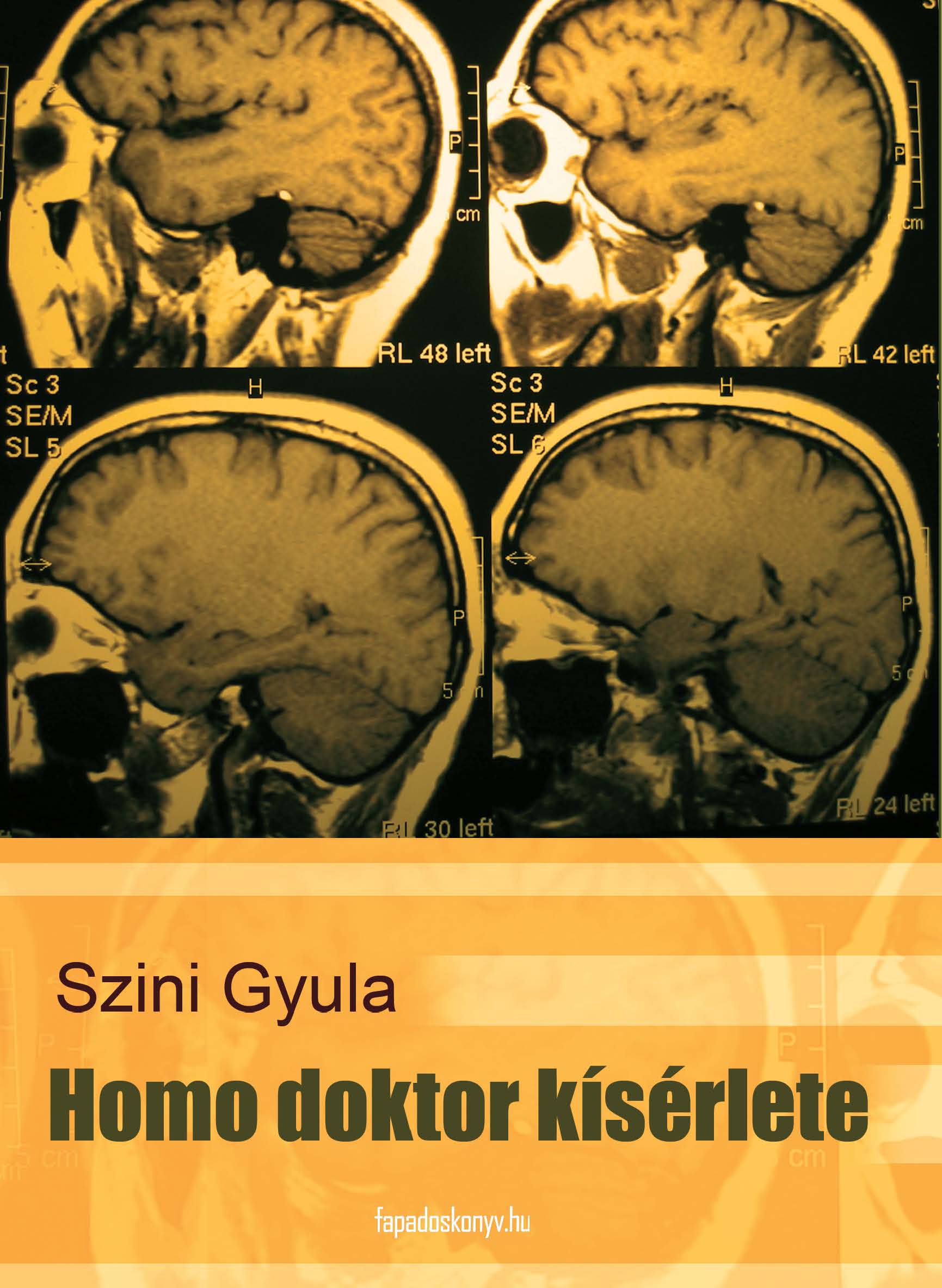 Homo doktor kísérlete